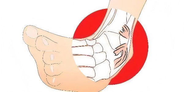 踝關(guān)節(jié)扭傷后的最佳應(yīng)對(duì)指南：簡(jiǎn)單四步，助力快速康復(fù)！